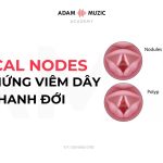 Vocal Nodes – Hội Chứng Viêm Dây Thanh Đới, Triệu Chứng Và Cách Phòng Tránh